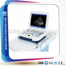 ecografos portatil& laptop ultrasound machine DW500